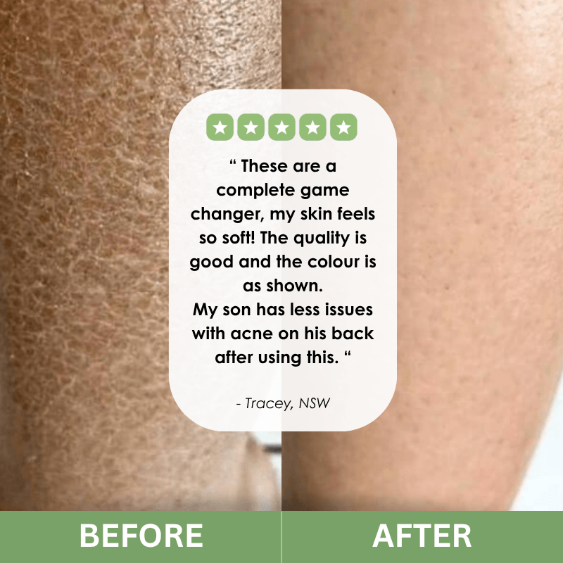 CalmCore™ Exfoliating Towel