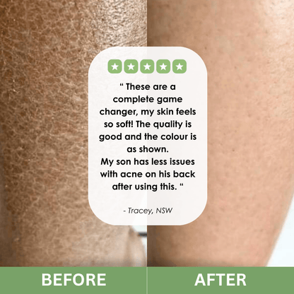 CalmCore™ Exfoliating Towel
